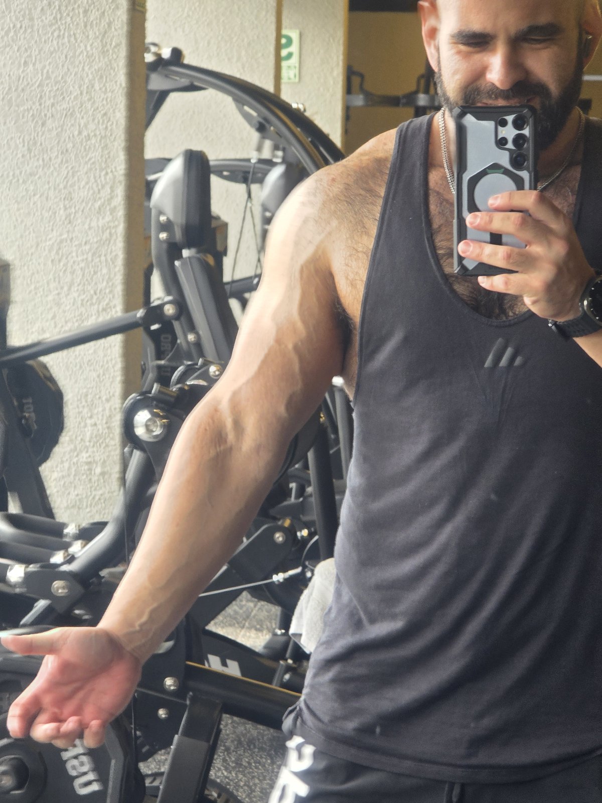 Renzo showing vascularity — November 2025